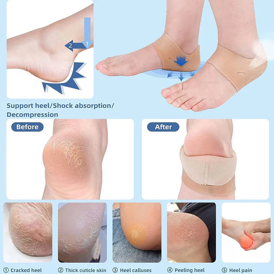 Gel Heel Cushion OM9-012 – Comfortable Pain Relief for Heels